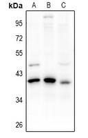 PDIK1L Rabbit Polyclonal Antibody