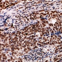 PDIK1L Rabbit Polyclonal Antibody