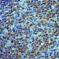 OATP2 Rabbit Polyclonal Antibody