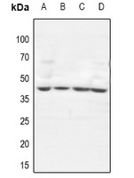GTF3A Rabbit Polyclonal Antibody
