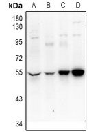 UEVLD Rabbit Polyclonal Antibody