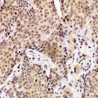 UEVLD Rabbit Polyclonal Antibody