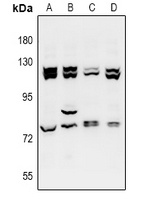 ZZZ3 Rabbit Polyclonal Antibody