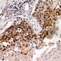 TRF3 Rabbit Polyclonal Antibody