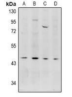 Acrosin Rabbit Polyclonal Antibody
