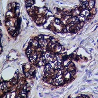 ADAM10 Rabbit Polyclonal Antibody