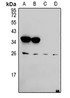 Ephrin A5 Rabbit Polyclonal Antibody