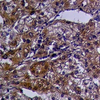 GPR124 Rabbit Polyclonal Antibody