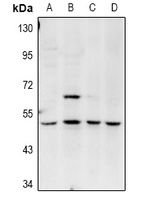 Amphiphysin 2 Rabbit Polyclonal Antibody