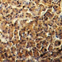 Amphiphysin 2 Rabbit Polyclonal Antibody
