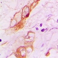 5-HT3A Rabbit Polyclonal Antibody