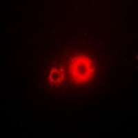 5-HT3A Rabbit Polyclonal Antibody
