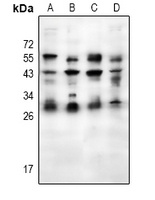 Placental lactogen Rabbit Polyclonal Antibody