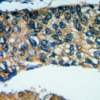 Placental lactogen Rabbit Polyclonal Antibody