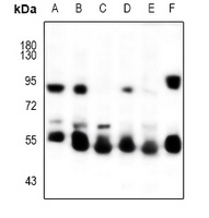 Cytokeratin-5/6 Rabbit Polyclonal Antibody