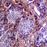Cytokeratin-5/6 Rabbit Polyclonal Antibody