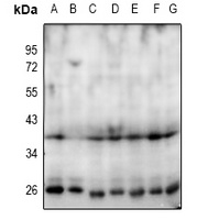 NANOG Rabbit Polyclonal Antibody