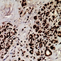 MEF2A (Phospho-S408) Antibody