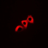 CRK (Phospho-Y221) Rabbit Polyclonal Antibody