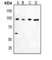 Glucocorticoid Receptor (Phospho-S226) Rabbit Polyclonal Antibody