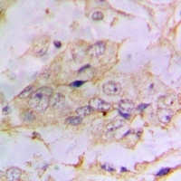 PTEN (Phospho-S385) Rabbit Polyclonal Antibody