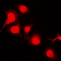 BRK (Phospho-Y447) Rabbit Polyclonal Antibody