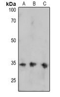 FOSB (Phospho-S27) Antibody