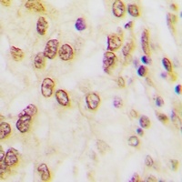 FOSB (Phospho-S27) Antibody