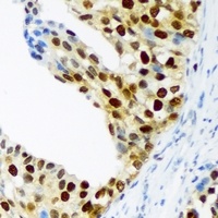 p57 Kip2 (Phospho-T310) Antibody