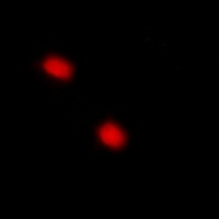 p57 Kip2 (Phospho-T310) Antibody