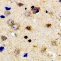 TPH1 (Phospho-S58) Rabbit Polyclonal Antibody
