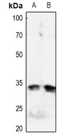 IGFBP3 (Phospho-S183) Antibody