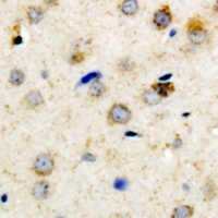 IGFBP3 (Phospho-S183) Antibody