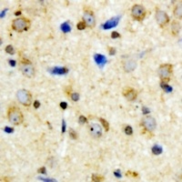 Kir6.2 (Phospho-T224) Antibody