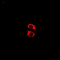 Kir6.2 (Phospho-T224) Antibody