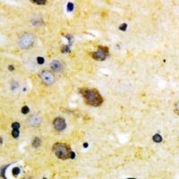 MKK4 (Phospho-S257) Rabbit Polyclonal Antibody
