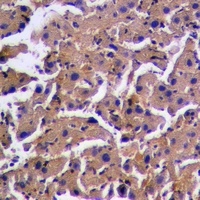 PINK1 (Phospho-S228) Antibody