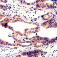 MARCKS (Phospho-S158) Antibody