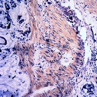 Vimentin (Phospho-S39) Antibody