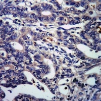 DSCR1 (Phospho-S108) Antibody