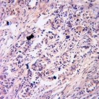 PKC gamma (Phospho-T514) Antibody