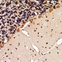TSG101 Rabbit Polyclonal Antibody