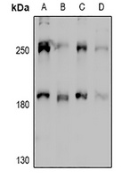 MYO10 Rabbit Polyclonal Antibody
