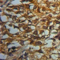 MYO10 Rabbit Polyclonal Antibody