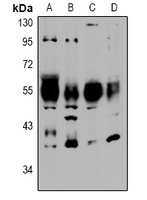NTR2 Rabbit Polyclonal Antibody