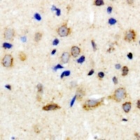 NTR2 Rabbit Polyclonal Antibody