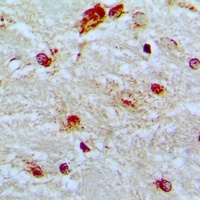 SF1 Rabbit Polyclonal Antibody