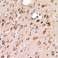 IRE1 Mouse Monoclonal Antibody