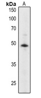 ABI2 Rabbit Polyclonal Antibody