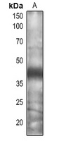 CSN5A/B Rabbit Polyclonal Antibody